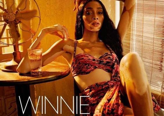 Winnie Harlow Is Exquisite, Lensed in Rich Images by Billy Kidd for Vogue India — Anne of Carversville