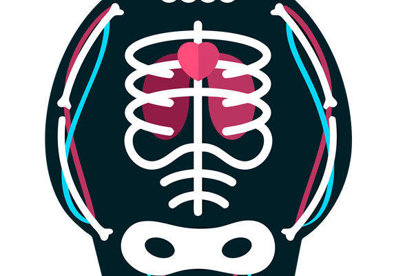 创意人体骨骼裁片印花服装，展现独特个性的服装印花设计